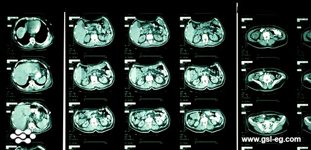 الأشعة المقطعية متعددة الشرائح Multi-Slice CT Scan - جاما سكان لاب ...